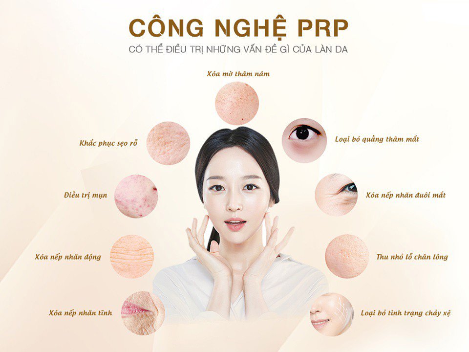 công nghệ PRP