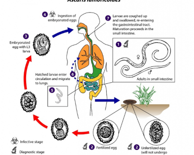  CÁC PHƯƠNG PHÁP XÉT NGHIỆM CHẨN ĐOÁN NHIỄM GIUN ĐŨA (ASCARIS LUMBRICOIDES)