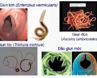 7 Loại Giun Sán Ký Sinh Ăn Mòn Sức Khỏe Bạn Cần Phải Biết