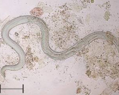 Giun Lươn Strongyloides Stercoralis Là Gì? 