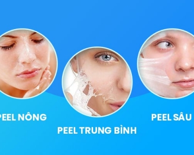 Nên Lựa Chọn Cấp Độ Peel Da Nào Phù Hợp Với Bạn ? 