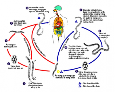 XÉT NGHIỆM CHẨN ĐOÁN GIUN LƯƠN (STRONGLYLOIDES STERCORALIS)