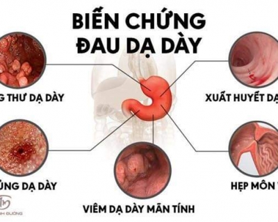 Viêm Dạ Dày - Căn Bệnh Thời Đại